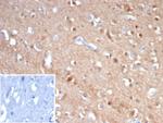 Tubulin beta 3/TUBB3 (Neuronal and Stem Cell Marker) Monoclonal Antibody (rTUBB3/7406)