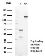 Tubulin beta 3/TUBB3 (Neuronal and Stem Cell Marker) Antibody in SDS-PAGE (SDS-PAGE)
