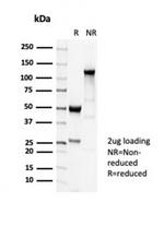 Tubulin beta 3/TUBB3 (Neuronal and Stem Cell Marker) Antibody in Immunoelectrophoresis (IE)