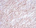 Tubulin beta 3/TUBB3 (Neuronal and Stem Cell Marker) Recombinant Rabbit Monoclonal Antibody (TUBB3/7089R)