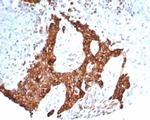 Tubulin beta 3/TUBB3 (Neuronal and Stem Cell Marker) Recombinant Rabbit Monoclonal Antibody (TUBB3/7090R)