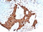 Tubulin beta 3/TUBB3 (Neuronal and Stem Cell Marker) Recombinant Rabbit Monoclonal Antibody (TUBB3/7090R)