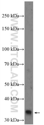 RFC5 Antibody in Western Blot (WB)