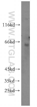 KRBP Antibody in Western Blot (WB)