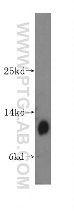 DNAL4 Antibody in Western Blot (WB)