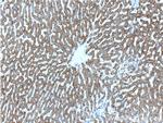 HGS Antibody in Immunohistochemistry (Paraffin) (IHC (P))