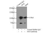HGS Antibody in Immunoprecipitation (IP)
