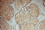 USP2 Antibody in Immunohistochemistry (Paraffin) (IHC (P))
