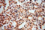 USP2 Antibody in Immunohistochemistry (Paraffin) (IHC (P))