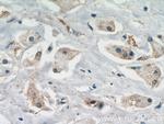USP2 Antibody in Immunohistochemistry (Paraffin) (IHC (P))