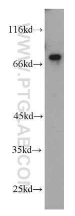 USP2 Antibody in Western Blot (WB)