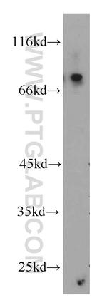 USP2 Antibody in Western Blot (WB)