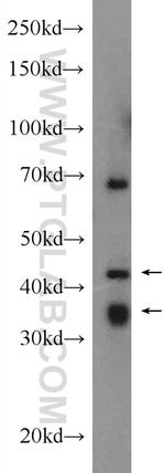 USP2 Antibody in Western Blot (WB)