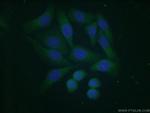 COMMD5 Antibody in Immunocytochemistry (ICC/IF)