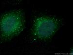 COMMD5 Antibody in Immunocytochemistry (ICC/IF)