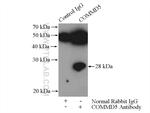 COMMD5 Antibody in Immunoprecipitation (IP)