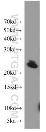 COMMD5 Antibody in Western Blot (WB)