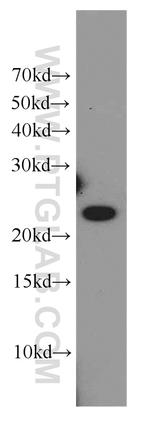 COMMD5 Antibody in Western Blot (WB)