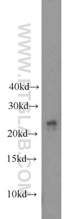 COMMD5 Antibody in Western Blot (WB)