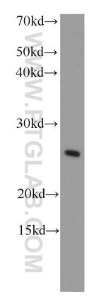COMMD5 Antibody in Western Blot (WB)