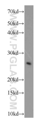 COMMD5 Antibody in Western Blot (WB)