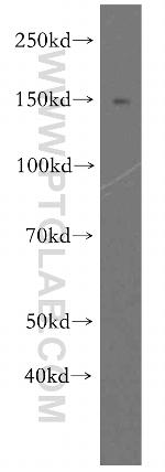 FMNL1 Antibody in Western Blot (WB)