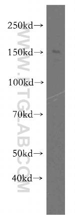 FMNL1 Antibody in Western Blot (WB)