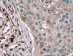 CARD14 Antibody in Immunohistochemistry (Paraffin) (IHC (P))