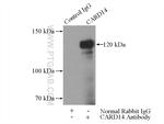 CARD14 Antibody in Immunoprecipitation (IP)