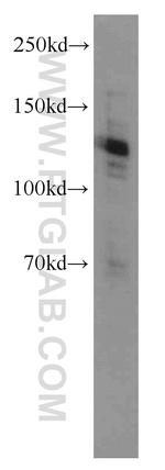 CARD14 Antibody in Western Blot (WB)