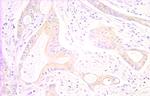 RAIDD Antibody in Immunohistochemistry (Paraffin) (IHC (P))