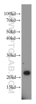 RAIDD Antibody in Western Blot (WB)