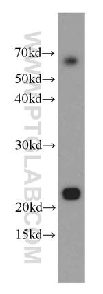 RAIDD Antibody in Western Blot (WB)