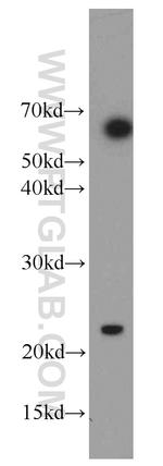 RAIDD Antibody in Western Blot (WB)