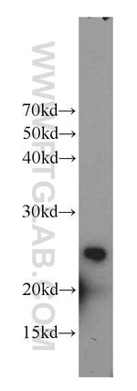 RAIDD Antibody in Western Blot (WB)