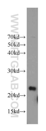 RAIDD Antibody in Western Blot (WB)