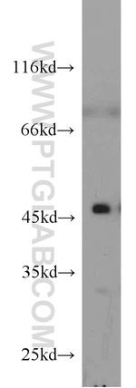 Cytohesin 2 Antibody in Western Blot (WB)