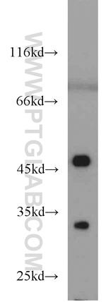 Cytohesin 2 Antibody in Western Blot (WB)