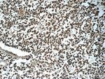 Syntenin 2 Antibody in Immunohistochemistry (Paraffin) (IHC (P))