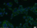 NFKB2 p100 Antibody in Immunocytochemistry (ICC/IF)