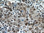 NFKB2 p100 Antibody in Immunohistochemistry (Paraffin) (IHC (P))