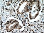 NFKB2 p100 Antibody in Immunohistochemistry (Paraffin) (IHC (P))
