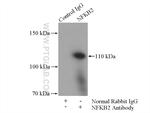 NFKB2 p100 Antibody in Immunoprecipitation (IP)