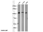 NFKB2 p100 Antibody in Western Blot (WB)