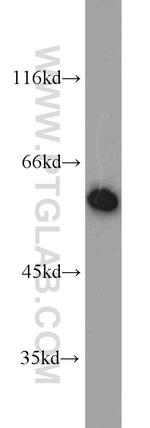 DMAP1 Antibody in Western Blot (WB)