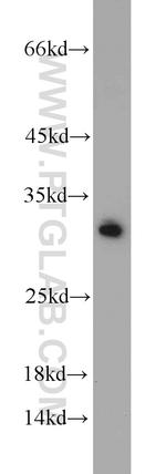 BCAS2 Antibody in Western Blot (WB)