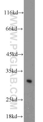 BCAS2 Antibody in Western Blot (WB)