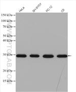 BCAS2 Antibody in Western Blot (WB)