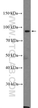 Calpain 3 Antibody in Western Blot (WB)