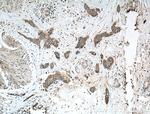 Calpain 3 Antibody in Immunohistochemistry (Paraffin) (IHC (P))